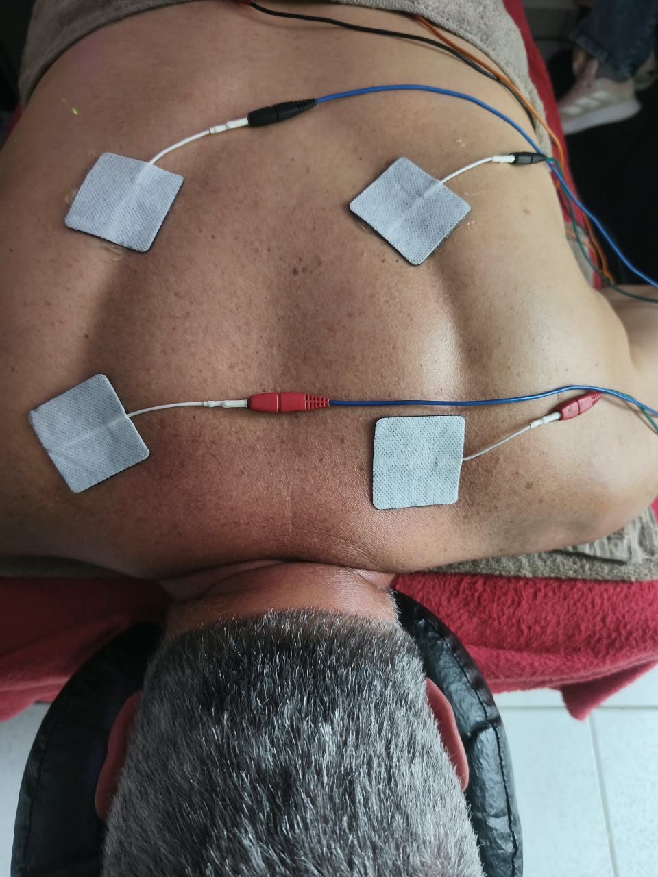 Aplicação de eletroterapia nas costas para alívio de tensão muscular